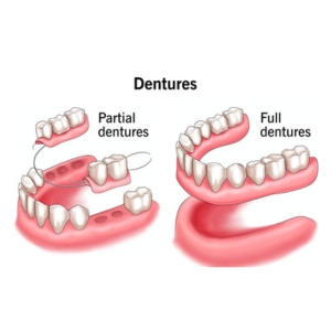 Dentures Service