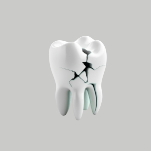 Dental Fracture Treatment